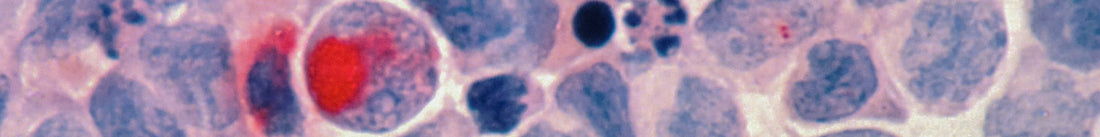 7 Key Cancer Risk Factors — And Practical Ways to Reduce Them
